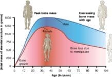 615 Age and Bone Mass Anatomy & Physiology, Connexions Web site. http cnx.org content col11496 1.6 , Jun 19, 2013., CC BY 3.0 https creativecommons.org licenses by 3.0 , via Wikimedia Commons