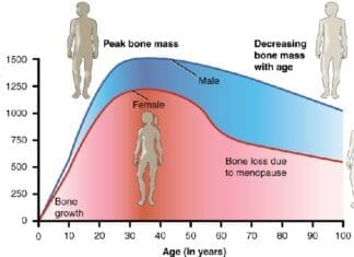 615 Age and Bone Mass Anatomy & Physiology, Connexions Web site. http cnx.org content col11496 1.6 , Jun 19, 2013., CC BY 3.0 https creativecommons.org licenses by 3.0 , via Wikimedia Commons
