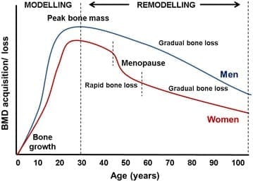 bone osteoporsis