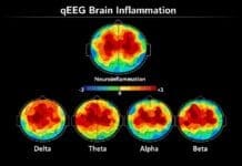 When Antidepressants Don’t Work: The Inflammation Connection Be Well brain inflammation