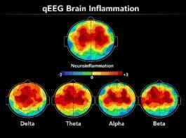 Be Well brain inflammation