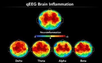 When Antidepressants Don’t Work: The Inflammation Connection Be Well brain inflammation