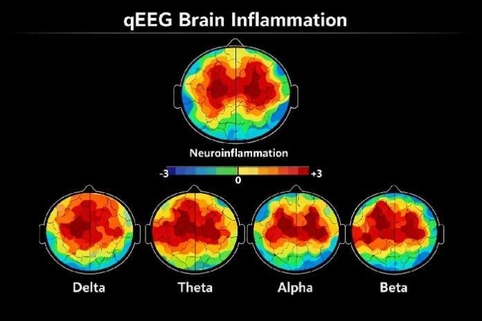 Be Well brain inflammation Be Well brain inflammation